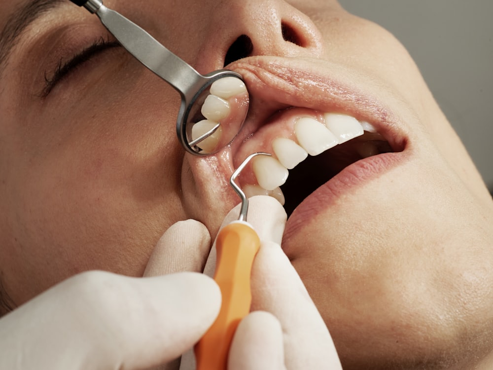 Why Turkey Is the World's Leading Dental Tourism Destination — Dental Treatment, VelaCare Turkey