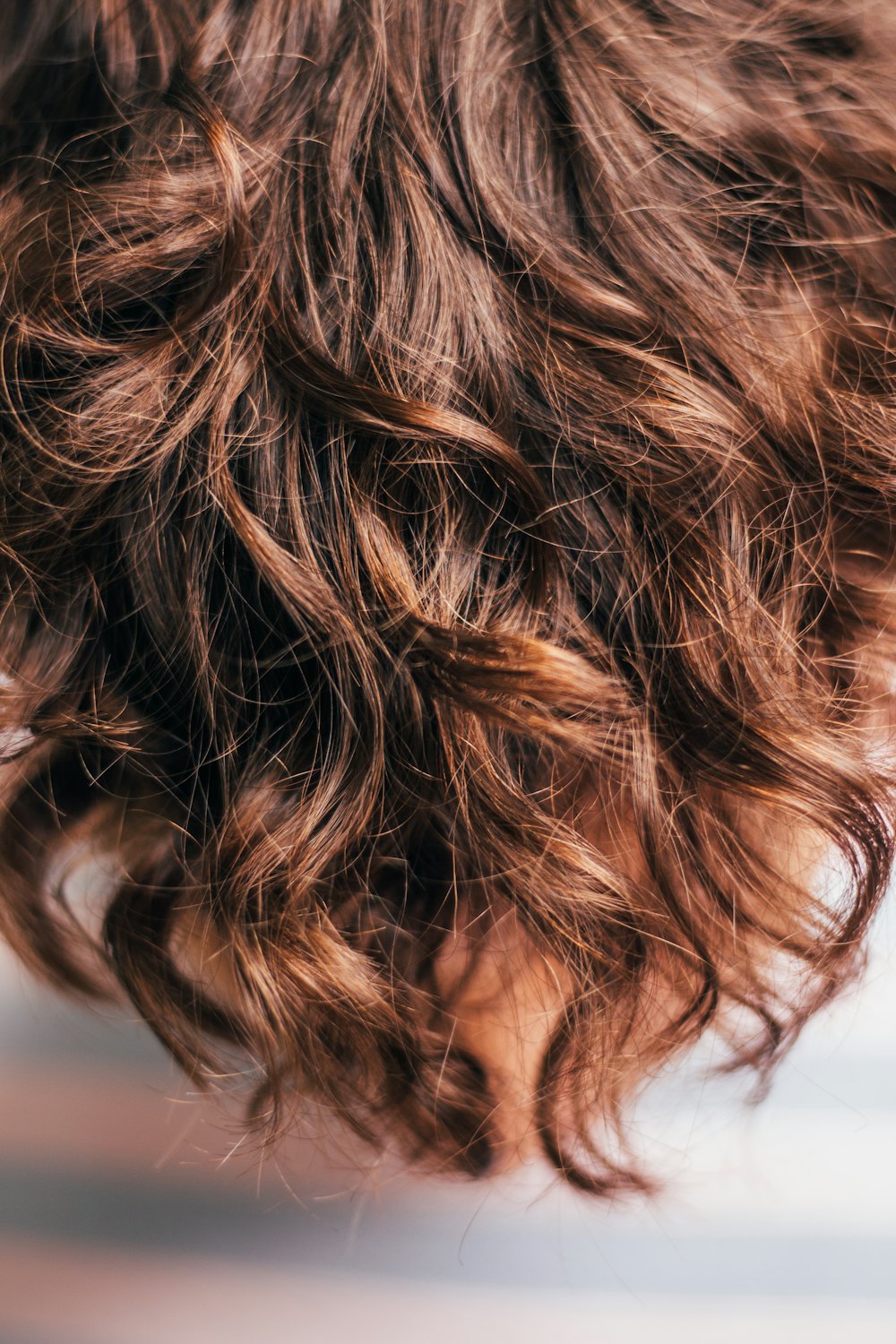 Istanbul — The Global Capital of Hair Transplantation — Hair Transplant, VelaCare Turkey